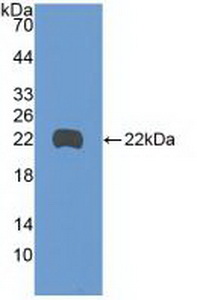 Growth Arrest And DNA Damage Inducible Protein Beta (GADD45b) Human Polyclonal Antibody