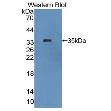Hermansky Pudlak Syndrome Protein 1 (HPS1) Mouse Polyclonal Antibody