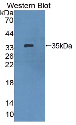 Hermansky Pudlak Syndrome Protein 1 (HPS1) Mouse Polyclonal Antibody