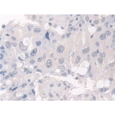 Hermansky Pudlak Syndrome Protein 4 (HPS4) Human Polyclonal Antibody