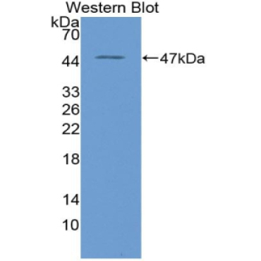 High Temperature Requirement Factor A1 (HTRA1) Human Polyclonal Antibody