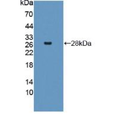 Interferon Induced Helicase C Domain Containing Protein 1 (IFIH1) Human Polyclonal Antibody