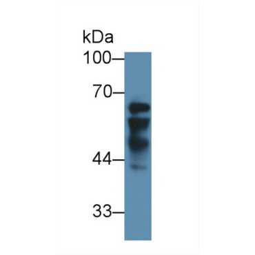 Insulin Like Growth Factor 2 mRNA Binding Protein 2 (IGF2BP2) Human Polyclonal Antibody
