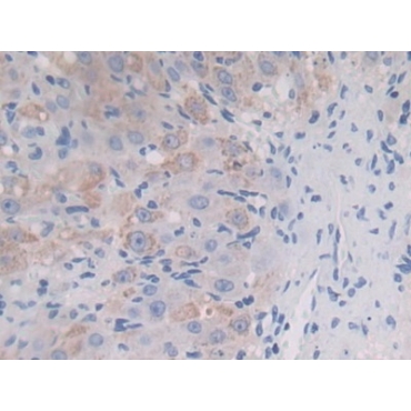 Insulin Like Growth Factor 2 mRNA Binding Protein 2 (IGF2BP2) Mouse Polyclonal Antibody