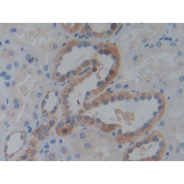 Insulin Like Growth Factor 2 mRNA Binding Protein 3 (IGF2BP3) Human Polyclonal Antibody