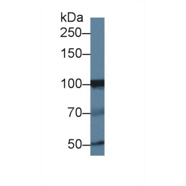 Inositol Polyphosphate-4-Phosphatase Type I 107kDa (INPP4A) Human Polyclonal Antibody