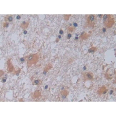 Jagged 2 Protein (JAG2) Human Polyclonal Antibody