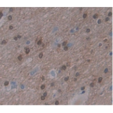 KH Domain Containing, RNA Binding, Signal Transduction Associated Protein 1 (KHDRBS1) Human Polyclonal Antibody