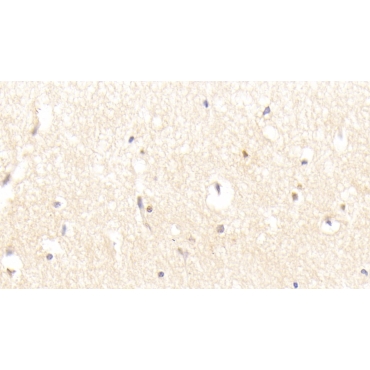 Leucine Rich Repeats And Immunoglobulin Like Domains Protein 1 (LRIG1) Human Polyclonal Antibody