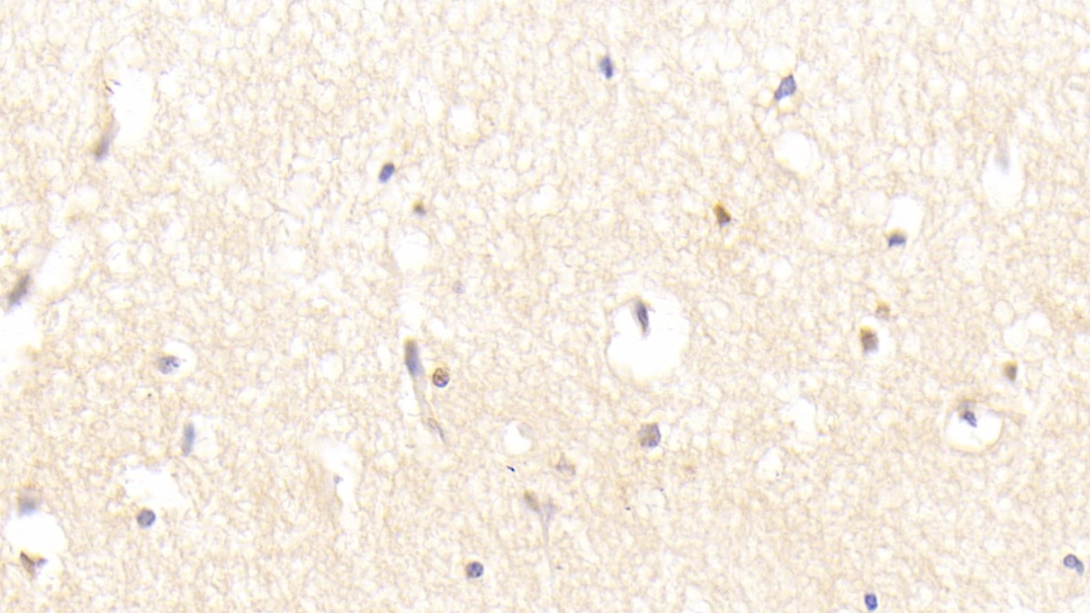Leucine Rich Repeats And Immunoglobulin Like Domains Protein 1 (LRIG1) Human Polyclonal Antibody