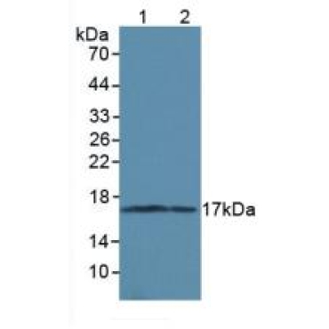 Microtubule Associated Protein 1 Light Chain 3 Alpha (MAP1LC3a) Human Polyclonal Antibody