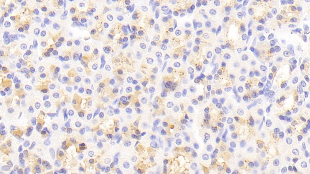 Mindbomb Homolog 2 (MIB2) Rat Polyclonal Antibody
