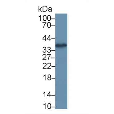 Aminoacyl tRNA Synthetase Complex Interacting Multifunctional Protein 1 (AIMP1) Human Polyclonal Antibody