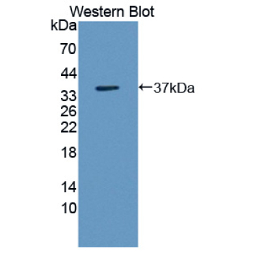 Wingless Type MMTV Integration Site Family, Member 3 (WNT3) Human Polyclonal Antibody