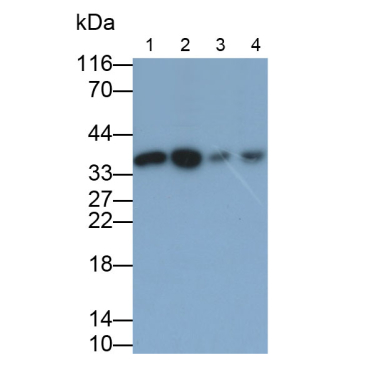 Otubain 1 (OTUB1) Human Polyclonal Antibody
