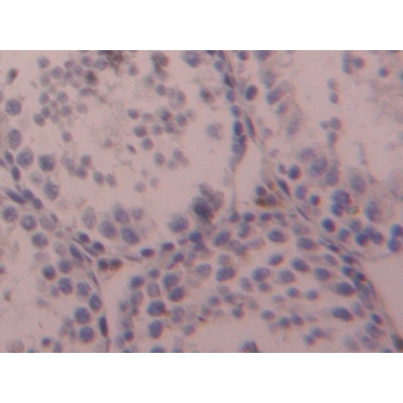 Otubain 1 (OTUB1) Mouse Polyclonal Antibody