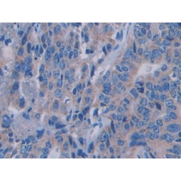 Semaphorin 3A (SEMA3A) Human Polyclonal Antibody