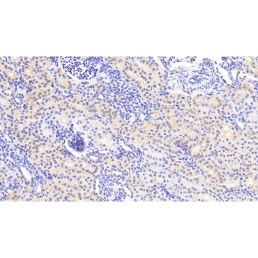 Semaphorin 3A (SEMA3A) Human Polyclonal Antibody