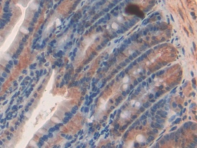Semaphorin 3A (SEMA3A) Rat Polyclonal Antibody