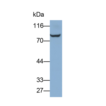 Semaphorin 3C (SEMA3C) Human Polyclonal Antibody
