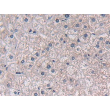 Semaphorin 3E (SEMA3E) Human Polyclonal Antibody