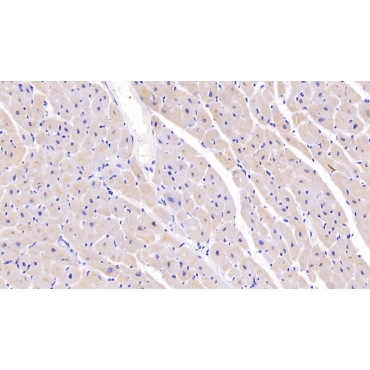 Semaphorin 5B (SEMA5B) Human Polyclonal Antibody