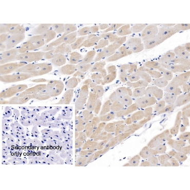 Semaphorin 5B (SEMA5B) Human Polyclonal Antibody