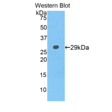 Neurofascin (NFASC) Human Polyclonal Antibody