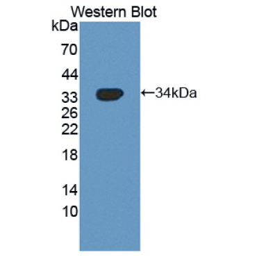 NUAK Family SNF1 Like Kinase 1 (NUAK1) Human Polyclonal Antibody