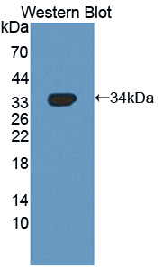 NUAK Family SNF1 Like Kinase 1 (NUAK1) Human Polyclonal Antibody
