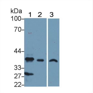 PDZ And LIM Domain Protein 1 (PDLIM1) Human Polyclonal Antibody