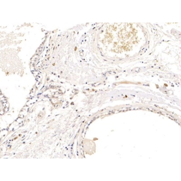 Prolactin Induced Protein (PIP) Human Polyclonal Antibody
