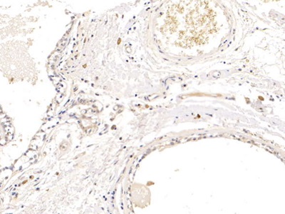 Prolactin Induced Protein (PIP) Human Polyclonal Antibody