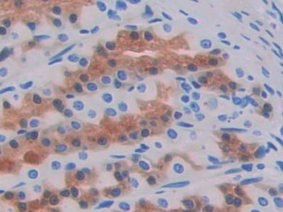 Prolactin Induced Protein (PIP) Rat Polyclonal Antibody