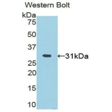 PR Domain Containing Protein 1 (PRDM1) Mouse Polyclonal Antibody