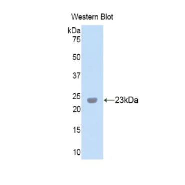 Peroxidasin Homolog (PXDN) Human Polyclonal Antibody
