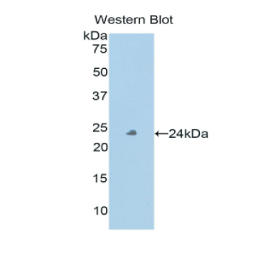 Peroxidasin Homolog (PXDN) Human Polyclonal Antibody
