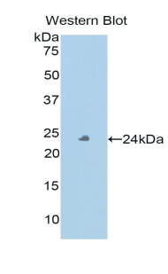 Peroxidasin Homolog (PXDN) Human Polyclonal Antibody