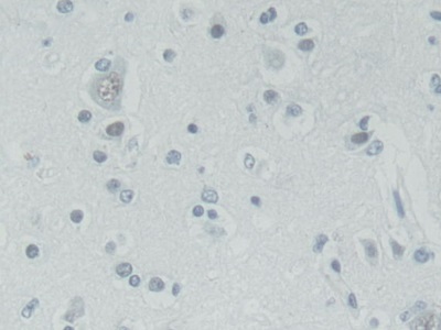 Pygopus Homolog 2 (PYGO2) Human Polyclonal Antibody