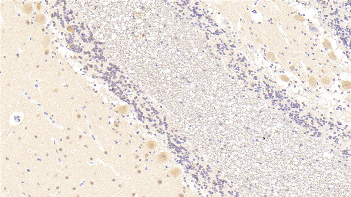 RCC1 And BTB Domain Containing Protein 2 (RCBTB2) Human Polyclonal Antibody