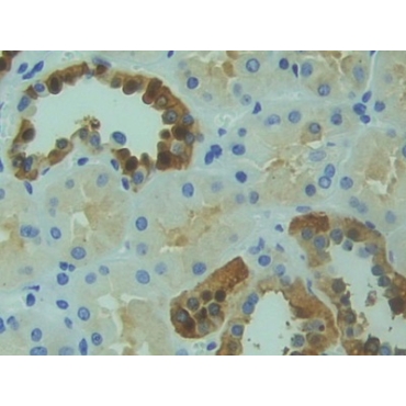 Receptor Tyrosine Kinase (RYK) Human Polyclonal Antibody