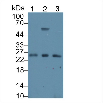 RNA Exonuclease 2 Homolog (REXO2) Human Polyclonal Antibody