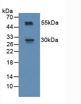R-Spondin 1 (RSPO1) Mouse Polyclonal Antibody