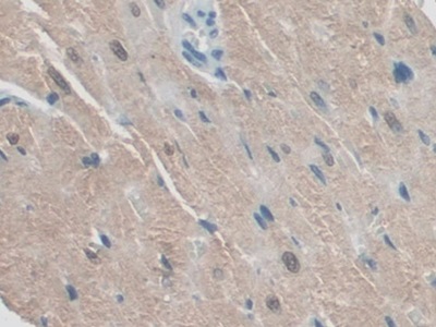 R-Spondin 1 (RSPO1) Rat Polyclonal Antibody
