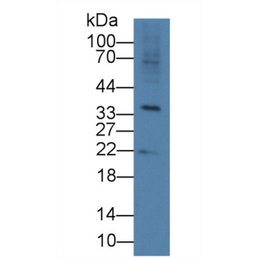 R-Spondin 3 (RSPO3) Human Polyclonal Antibody