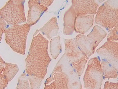 Single Ig IL1 Related Receptor (SIGIRR) Rat Polyclonal Antibody
