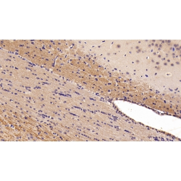 Salt Inducible Kinase 2 (SIK2) Human Polyclonal Antibody