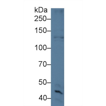 Cytospin B (CYTSB) Mouse Polyclonal Antibody