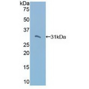 TNFRSF1A Associated Via Death Domain Protein (TRADD) Human Polyclonal Antibody