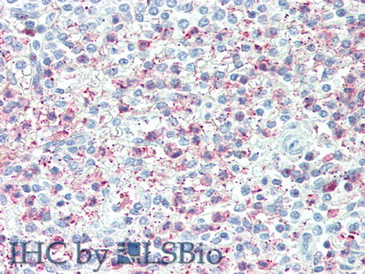 Tumor Necrosis Factor Alpha Induced Protein 6 (TNFaIP6) Mouse Polyclonal Antibody